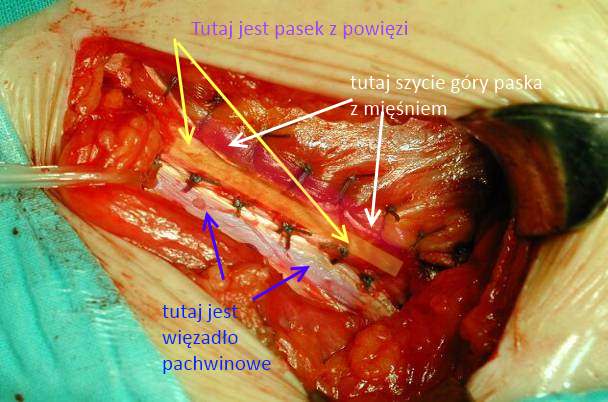 Desarda-koncowynapisy
