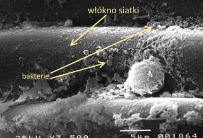 bakterie na powierzchni siatki